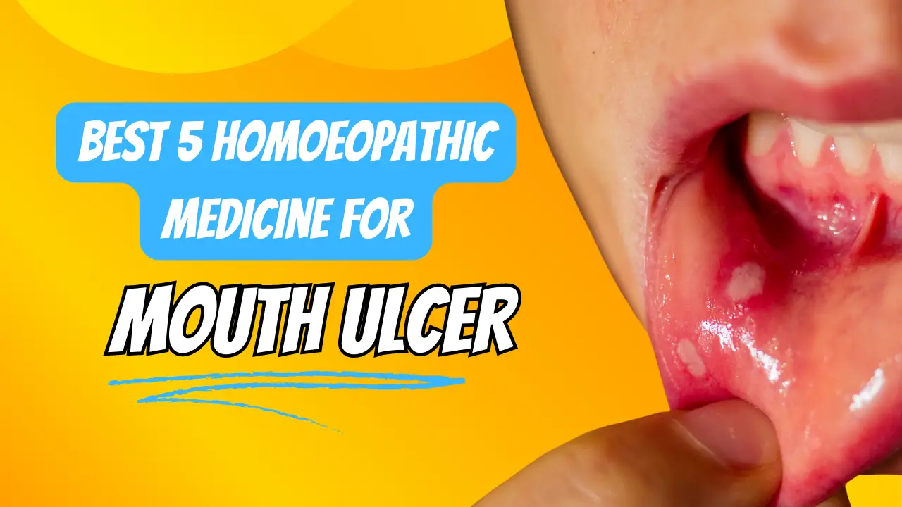 Os 5 melhores medicamentos homeopáticos para úlcera bucal