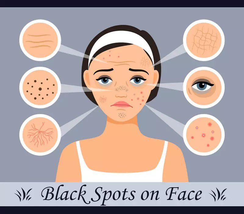 Black Spots On Face Image