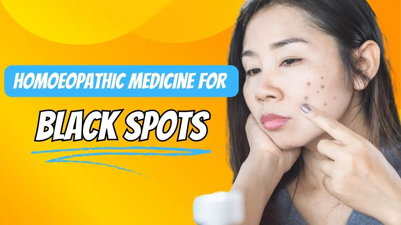 Homoeopathic medicine for black spots 1 1