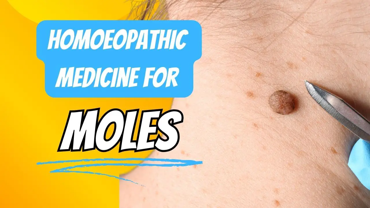 Homoeopathic medicine for moles