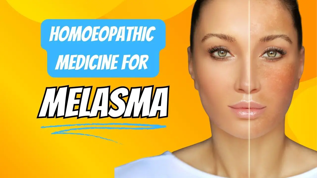 medicamento homeopático para melasma