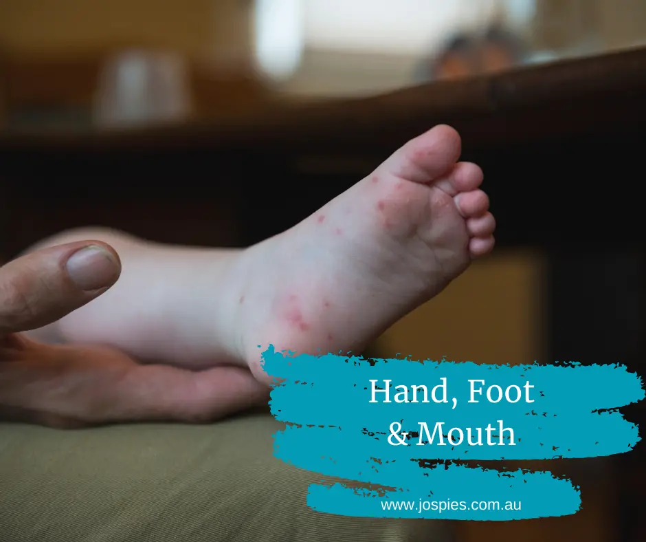 Medicina homeopática para la enfermedad de manos, pies y boca.