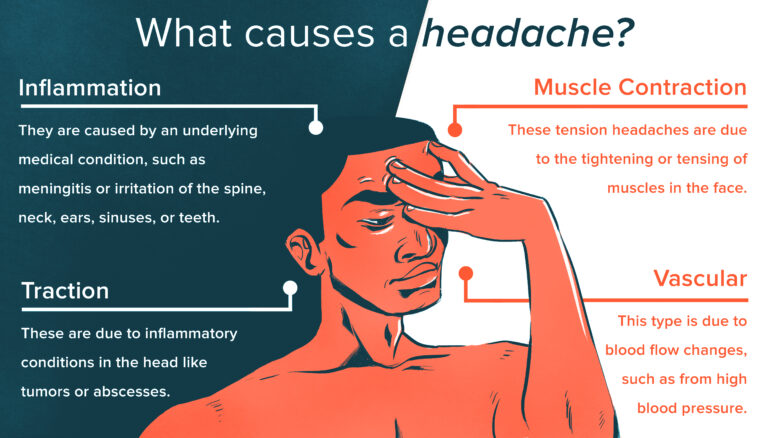 how to alleviate cold induced headaches