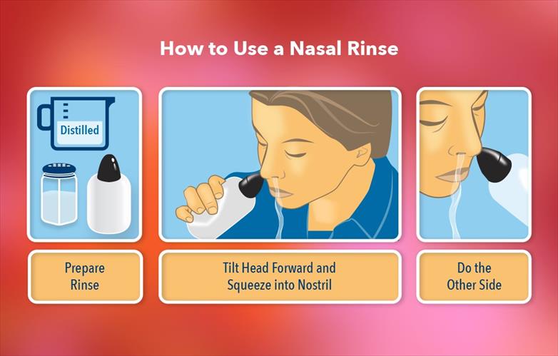cómo aliviar la congestión nasal